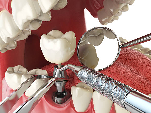 Best Emergency Treatment for Toothache in Arcola, VA